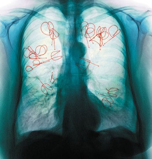 lungs.jpg