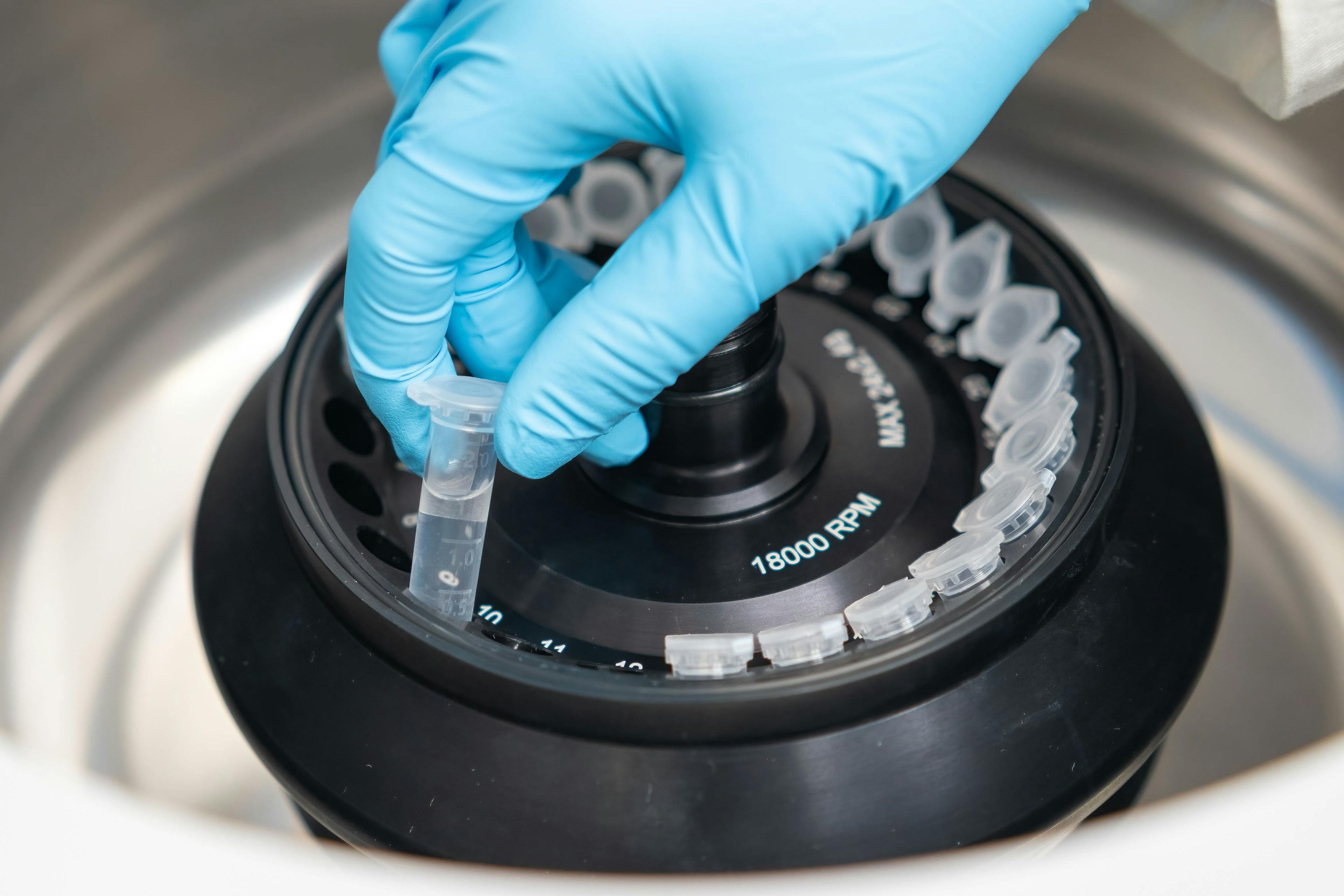 Scientist puts microcentrifuge tubes into centrifuge for phase separation. Metabolomic and lipidomic analysis in the analytical chemistry laboratory. | Image Credit: © vladim_ka - stock.adobe.com