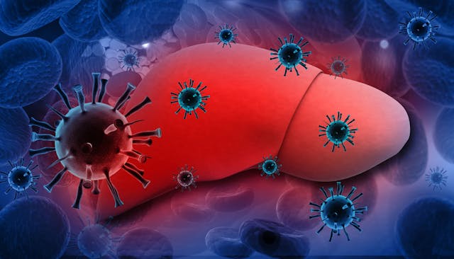 Liver Infection with hepatitis viruses. | Image Credit: © bluebay2014 - stock.adobe.com