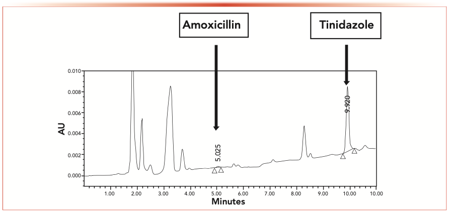 FIGURE 3: An original chromatogram from the analyzed patient samples.
