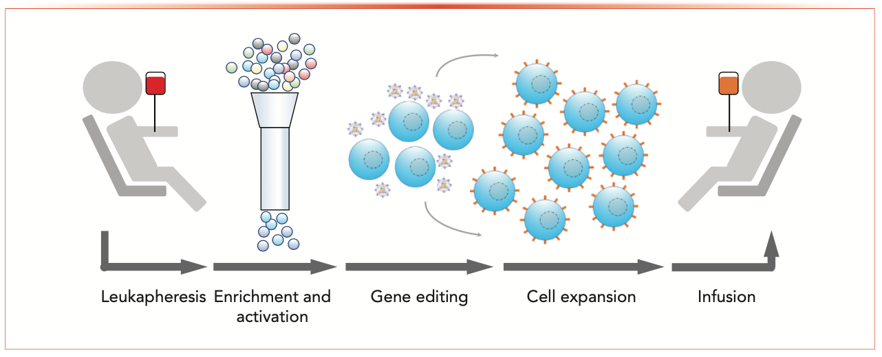 FIGURE 1: General chimeric antigen receptor T-cell (CAR-T) manufacturing process.