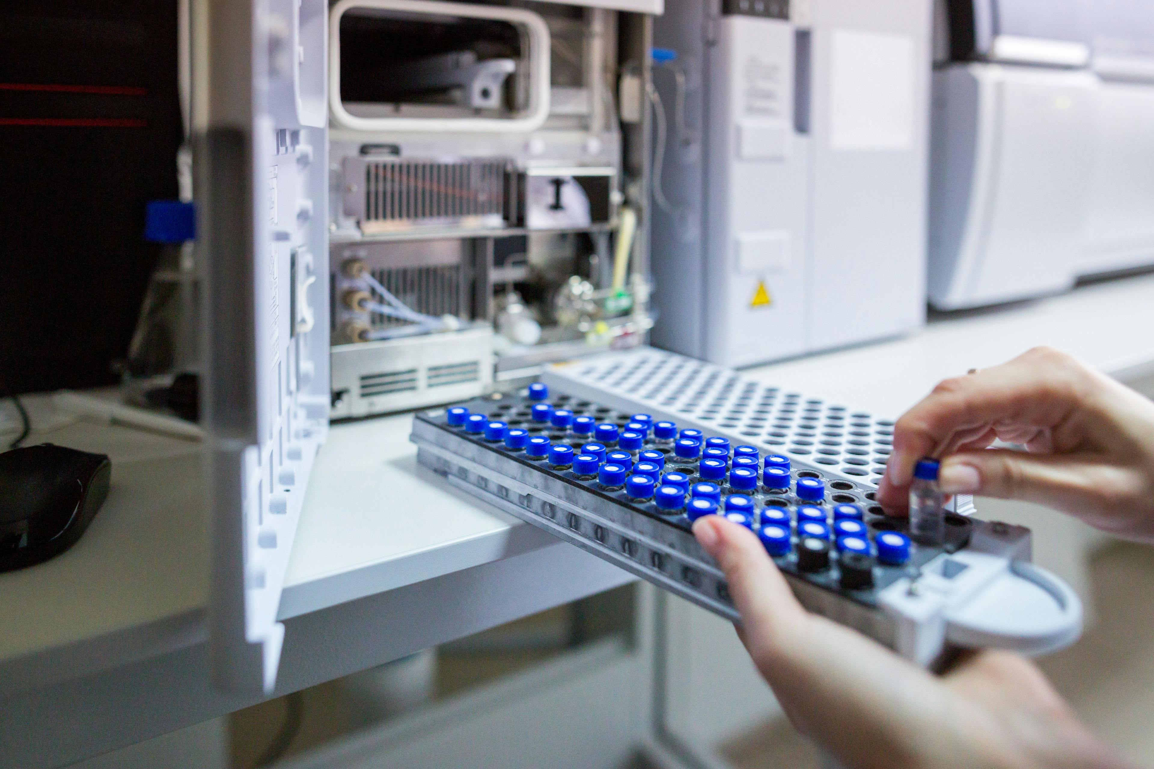 The laboratory scientist prepares samples for download to High-performance Liquid Chromatograph Mass Spectrometr. | Image Credit: © Sodel Vladyslav - stock.adobe.com